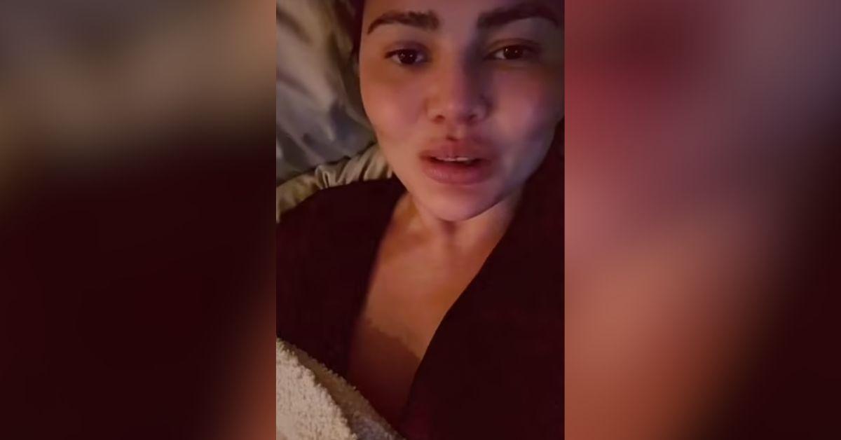 chrissy teigen new face