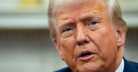 Donald Trump Sparks Health Fears By Sporting Heavily Bruised Hand