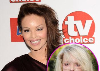 //katie piper acid getty zuma