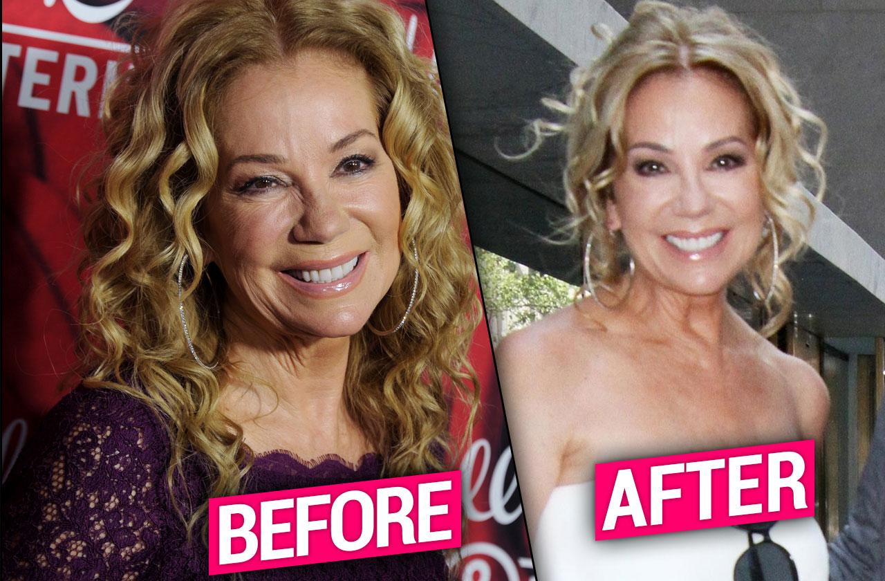 Kathie Lee Gifford Plastic Surgery Before After Pp 