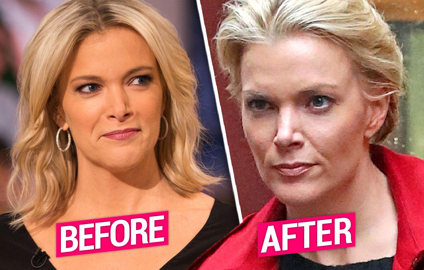 Megyn Kelly Shows Off New Cut After Getting Chopped From NBC