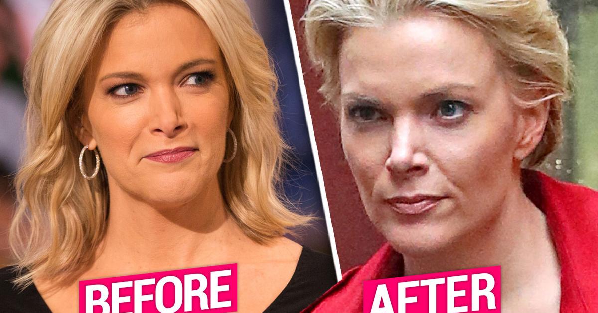 Megyn Kelly Shows Off New Cut After