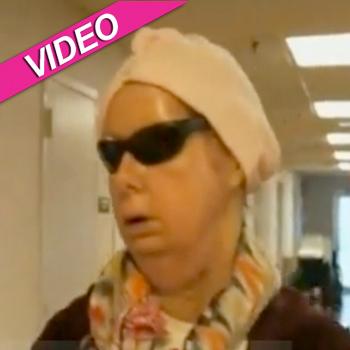 Chimp Attack Victim Charla Nash On Her New Face: ‘People Tell Me I Look ...