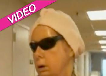 //charla nash chimp attack face transplant