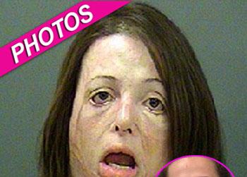 //heather raybon meth explosion face