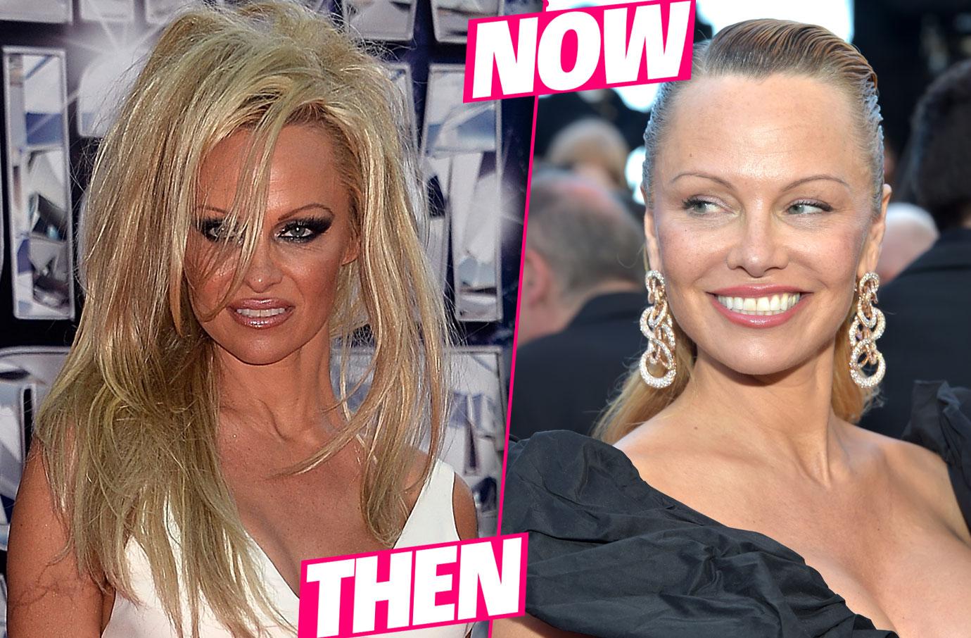 Pamela Anderson's Plastic Surgery Makeover Exposed By Top Docs
