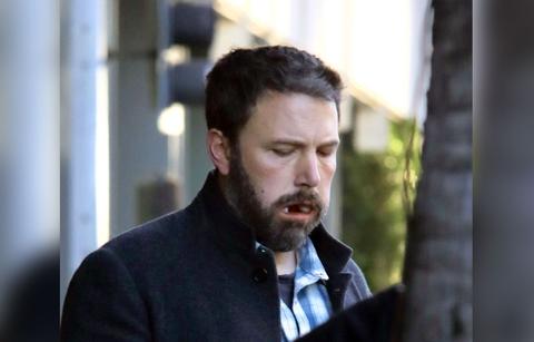 Ben Affleck Cotton Mouth Dental Surgery