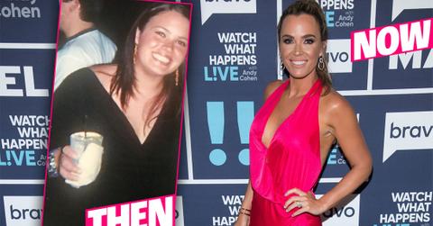 Teddi Mellencamp Says She Got Plastic Surgery After Weight Loss