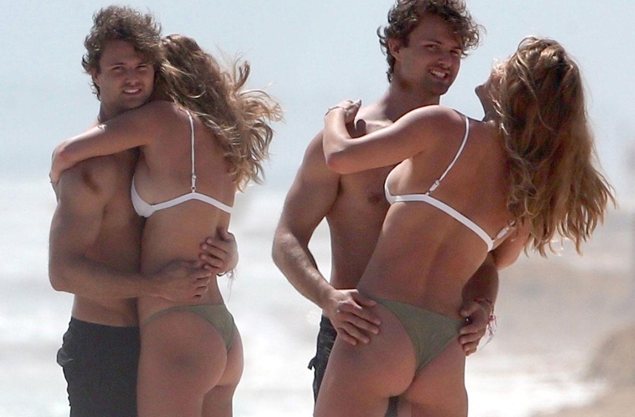 Sexiest Sunburn Ever! Peeling Nina Agdal Covers Breasts With Hands