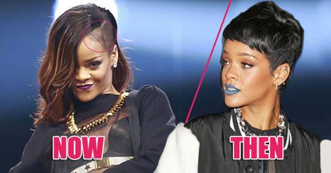 Rihanna-Suffering-Shocking-Hair-Loss-From-Over-Styling