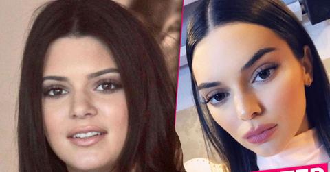 //Kendall Jenner Plastic Surgery FaceKendall Jenner Plastic Surgery Face pp
