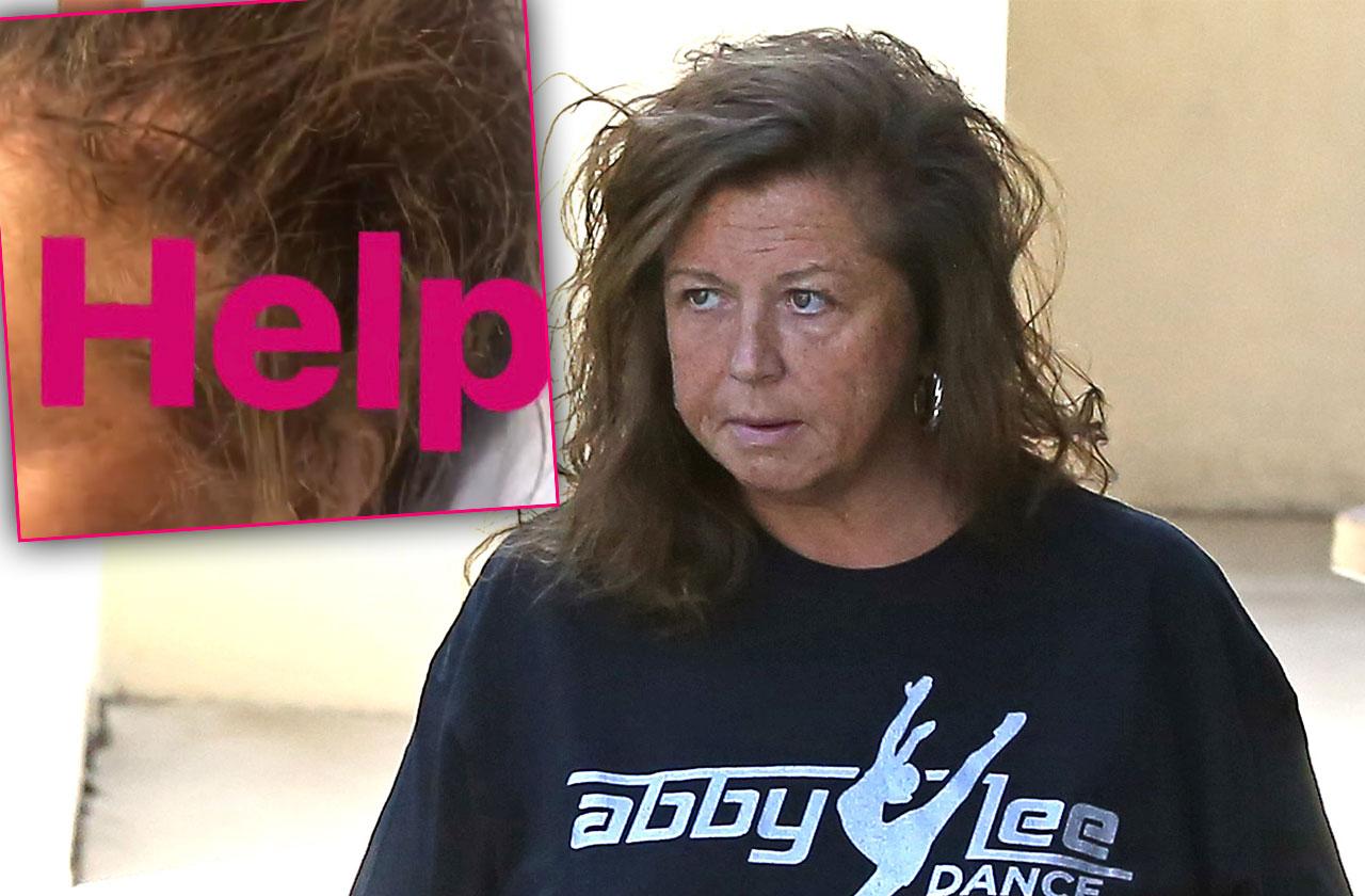 Abby Lee Miller marks 4 years since cancer diagnosis, becoming