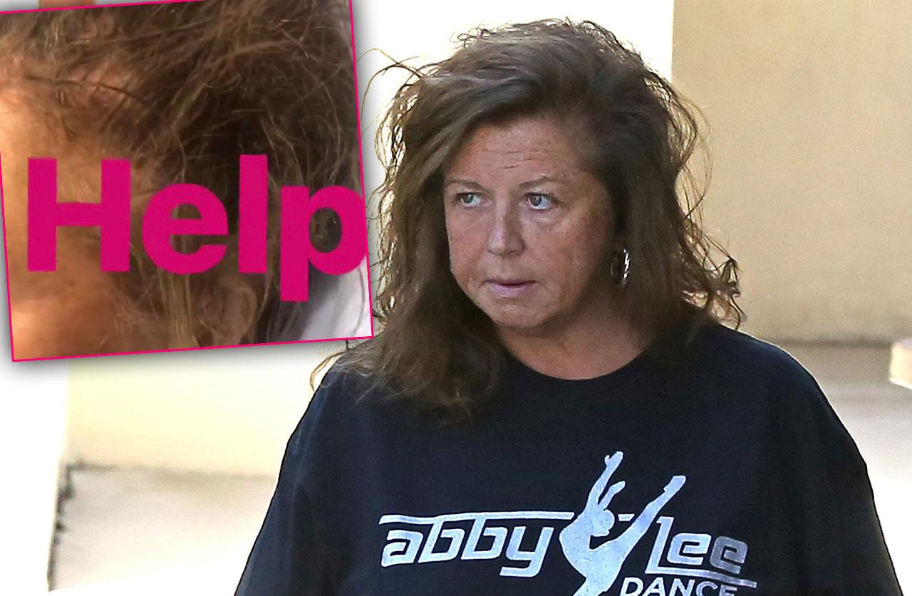 Abby Lee Miller Hair Falling Out Photos Cancer Treatment 'Dance Moms'