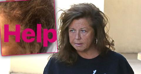 abby lee miller hair falling out cancer chemo