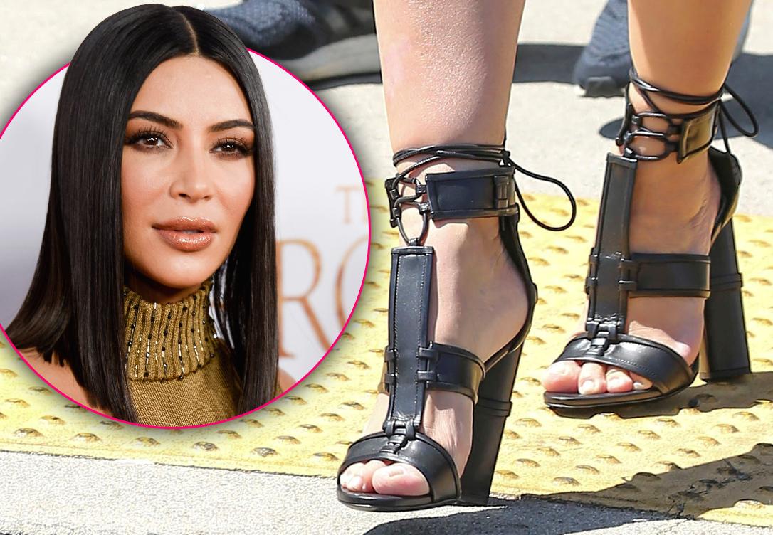 kim kardashian swollen feet cankles hammer toe surgery