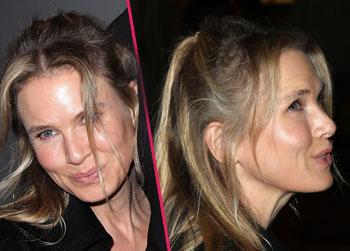 Renee Zellweger-Wide-Eyed-Frozen-Face-Botox