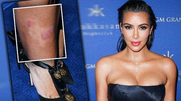 kim kardashian rash legs boobs cleavage las vegas party pics