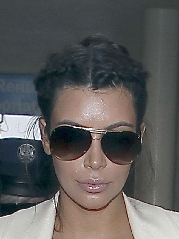 Kardashians Acne Rashes Photos