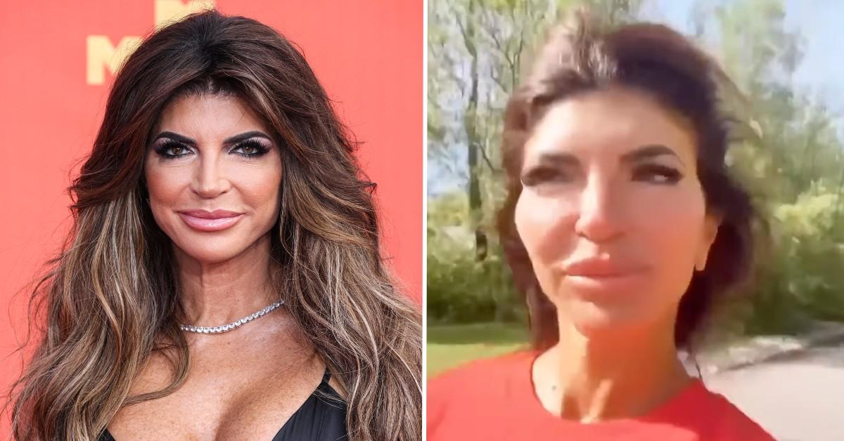 Teresa Giudice Looks Unrecognizable as Doctors Reveal What Plastic Surgery  Caused Shocking New Look