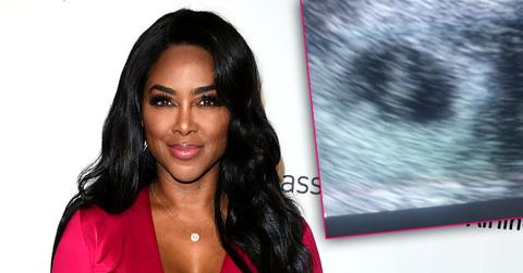 //kenya moore cries baby heartbeat ultrasound video rhoa PP