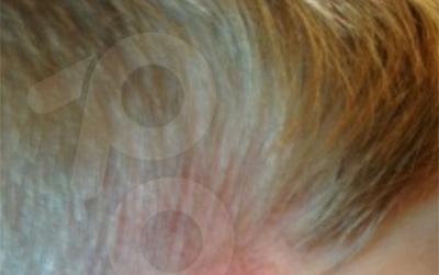 //bob sheen hurt charlie denise brooke