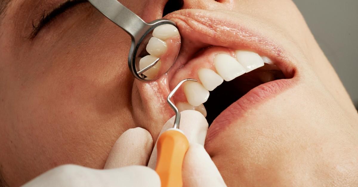 A woman in Florida has been accused of pretending to be a dentist.