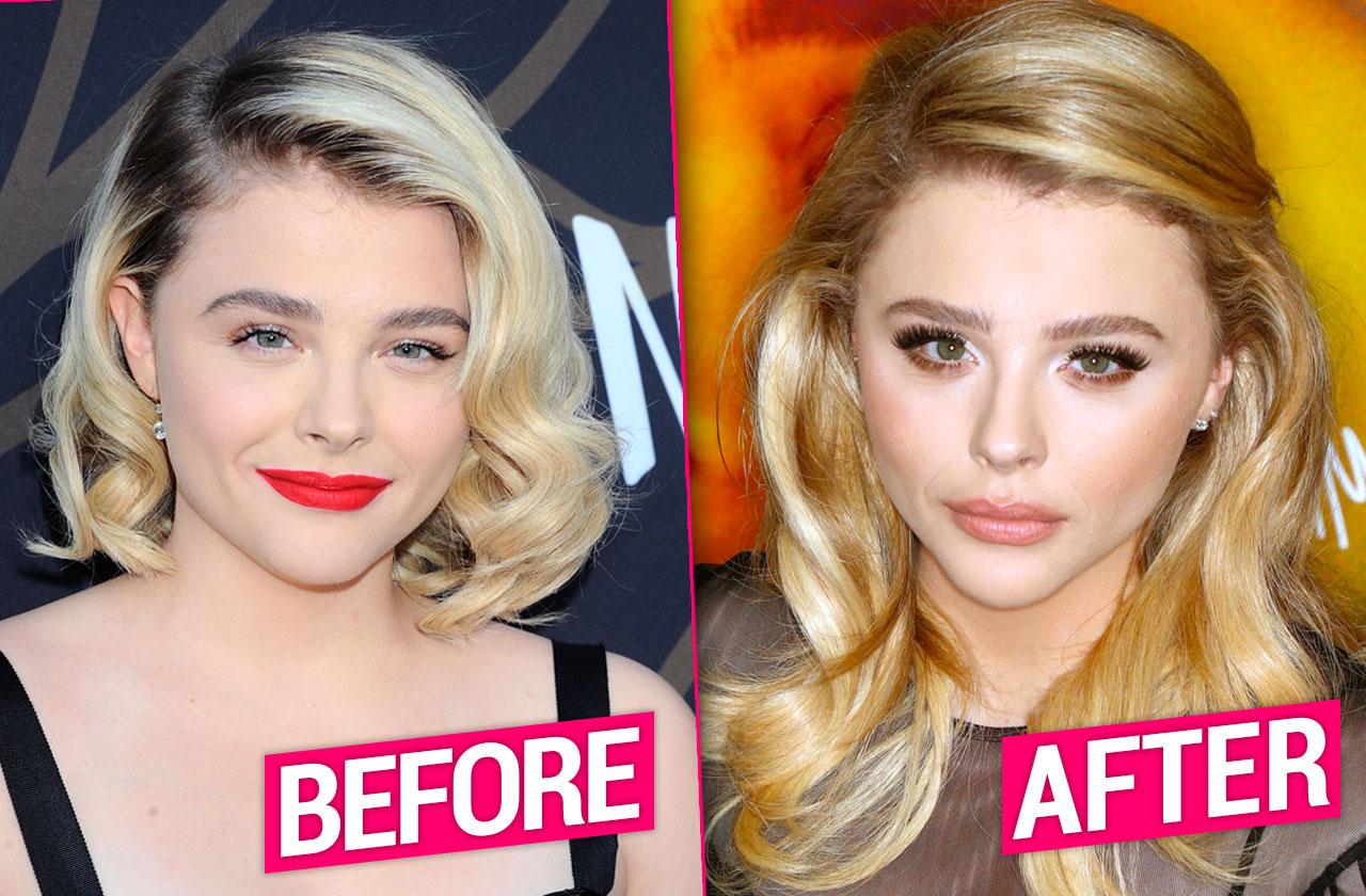 Chloe Grace Moretz Reveals Battle With Body Dysmorphia After