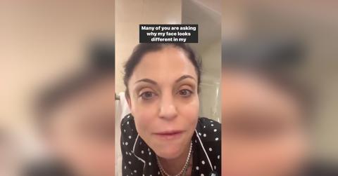 Ex-‘RHONY’ Star Bethenny Frankel Reveals Autoimmune Disease Struggles ...