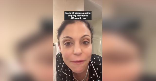 bethenny frankel reveals autoimmune disease struggles fans critcize her face pp