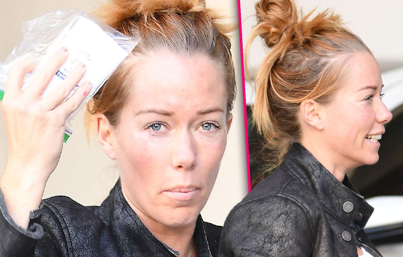 Kendra Wilkinson Gets Botox After Split From Hank