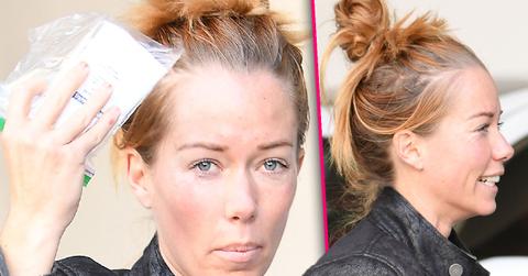 Kendra Wilkinson Gets Botox After Split From Hank
