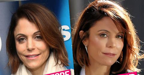 Bethenny Frankel Plastic Surgery