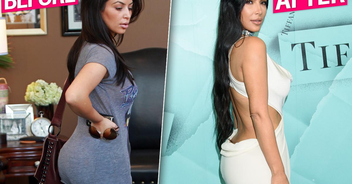 Kim Kardashian Gets Butt Implants Removed Claim Plastic Surgeons