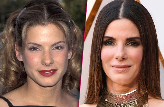 Sandra Bullock Plastic Surgery With Before And After Photos My XXX Hot Girl