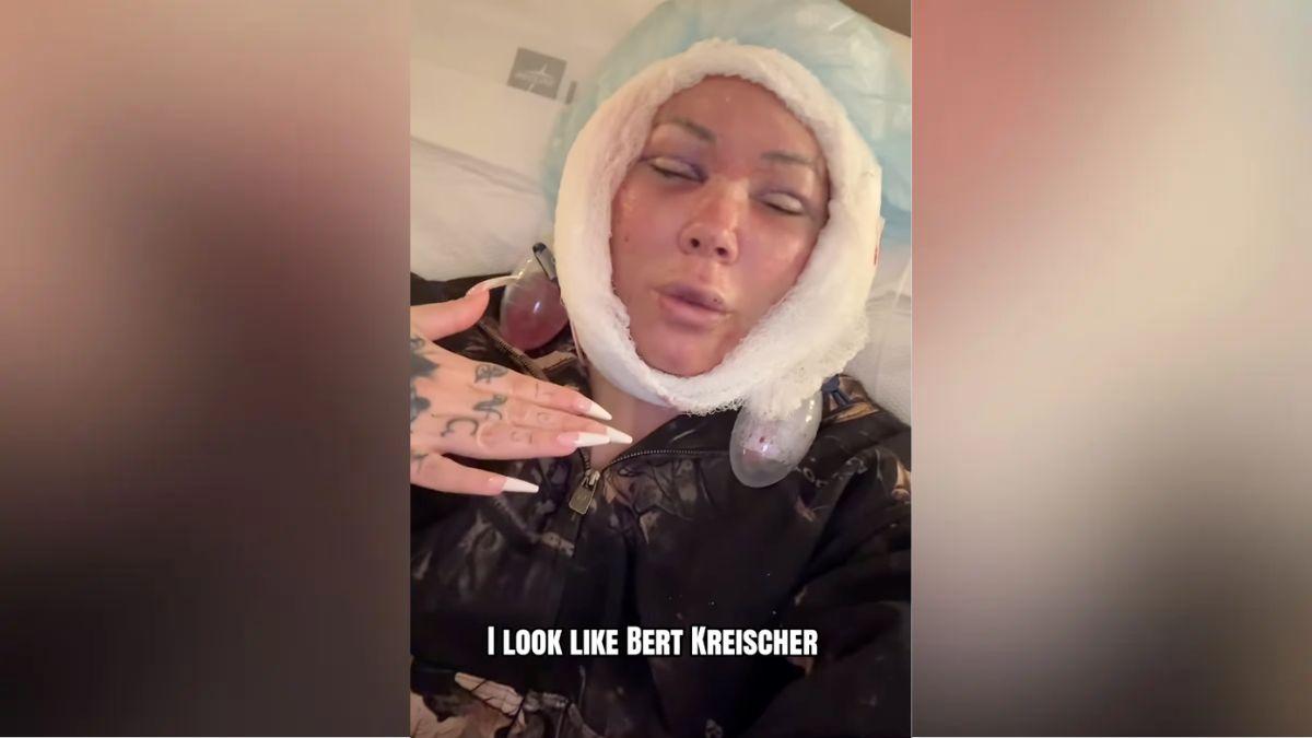 image of Her surgeon said the goal was subtle tweaks, not a dramatic transformation.