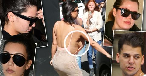 Kardashian Skin Problems