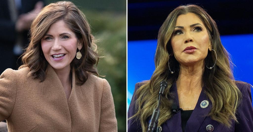 Kristi Noem's Plastic Surgery Revealed Fillers, Botox & MiniFacelift