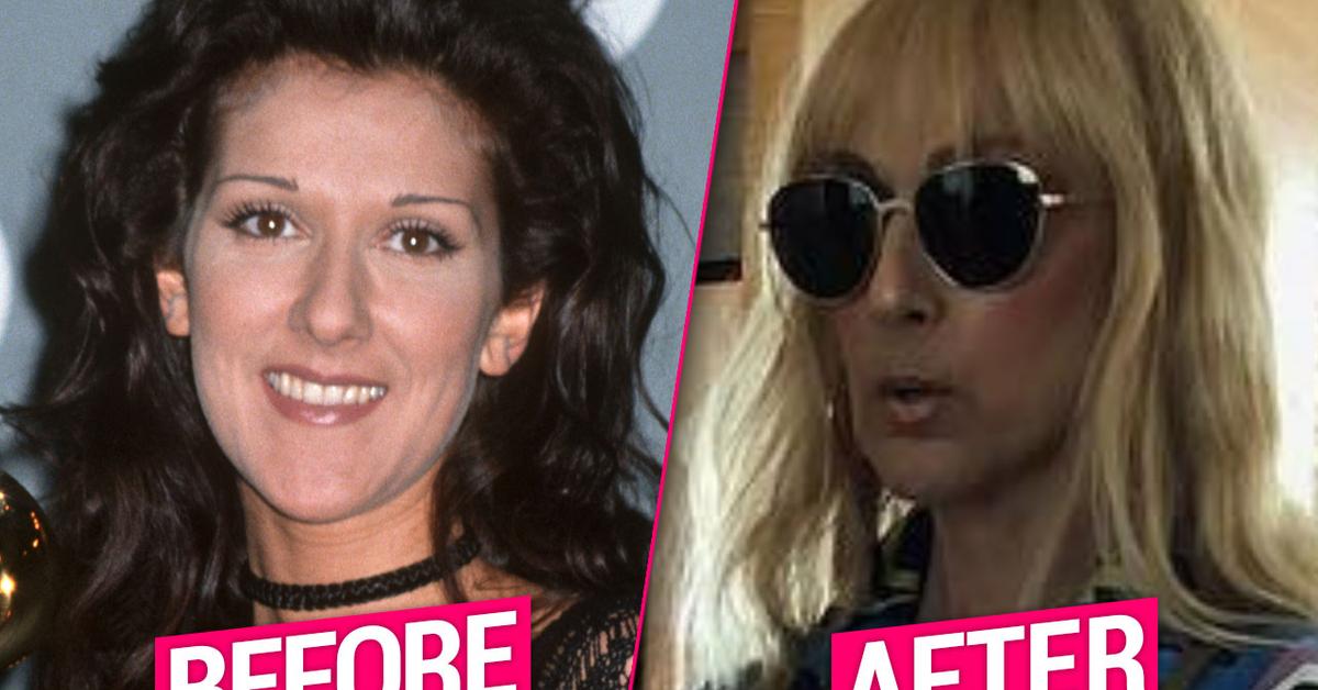 Celine Dion Unrecognizable After Plastic Surgery Nightmare(02)