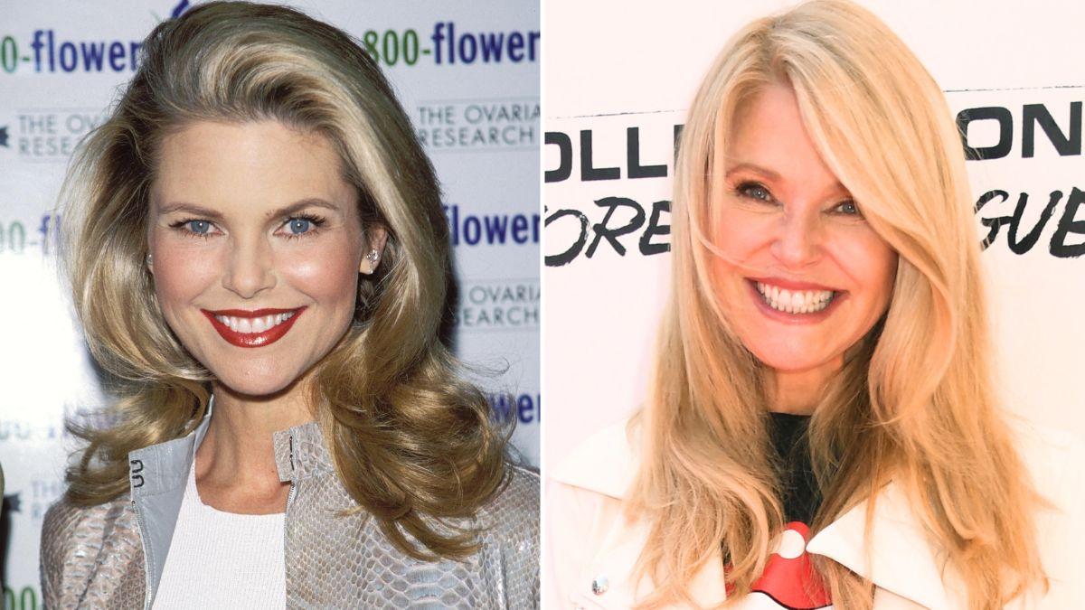 A plastic surgeon revealed Christie Brinkley may have had surgical work done in the 'distant past.'