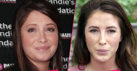 Bristol palin plastic surgery liposuction botox teen mom og