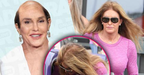 Caitlyn Jenner Going Bald Hair Loss Photos