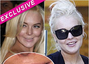 //lindsay lohan teeth dentist inf fame