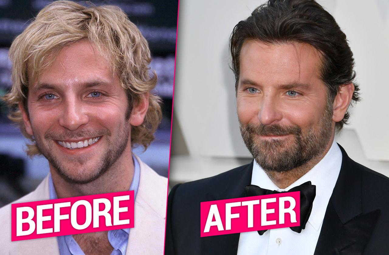 Bradley Cooper Faces Plastic Surgery Rumors About Nose Jawline   Bradley Cooper Plastic Surgery Pp1 