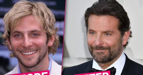 Bradley Cooper Plastic Surgery