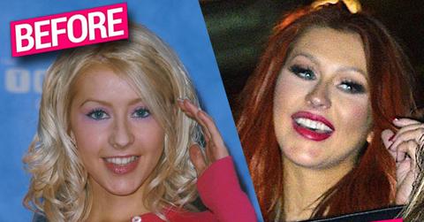 christina aguilera plastic surgery face cheek filler implants nose job