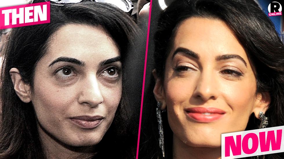 Plastic Is Perfect! Amal Clooney's Shocking New Face Is From Secret Surgery See Her