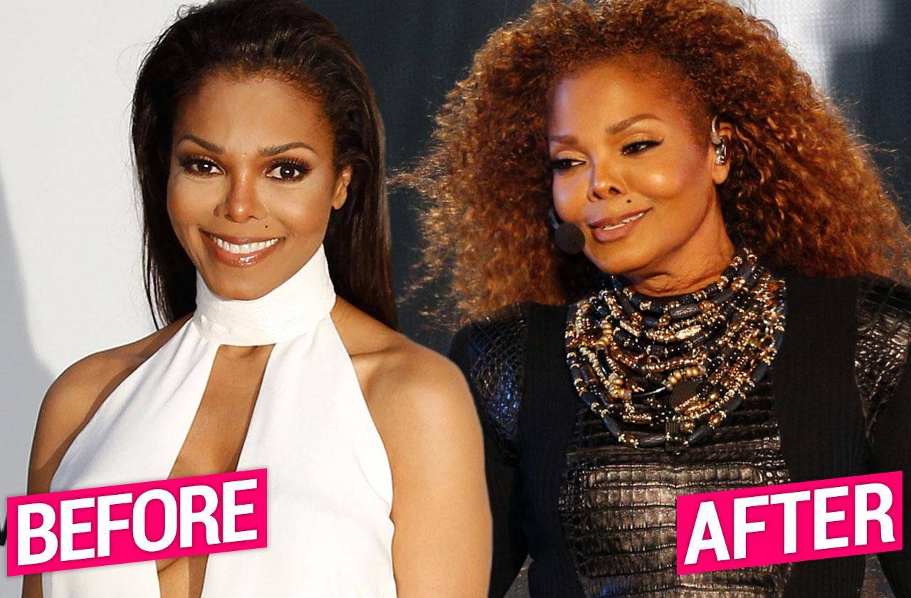 Janet Jackson Before After Plastic Surgery