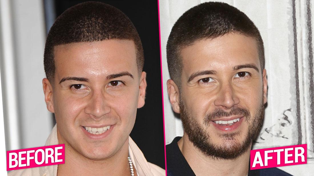 What happened to vinny from jersey shore