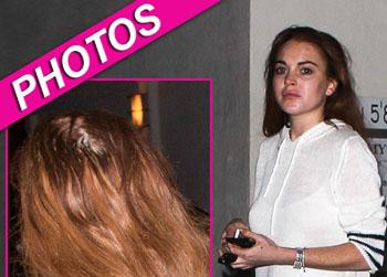 //lindsay lohan bald spot akm gsi sn