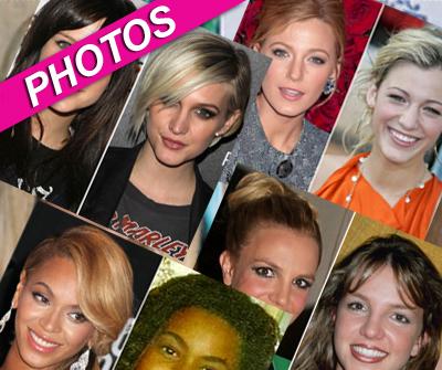 //celeb nose jobs wenngetty post